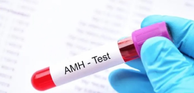 Anti-Mullerian Hormone