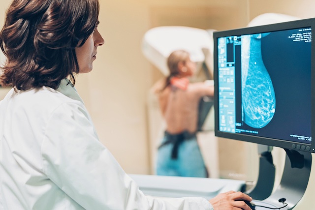 What Is Mammogram And How To Prepare For It?