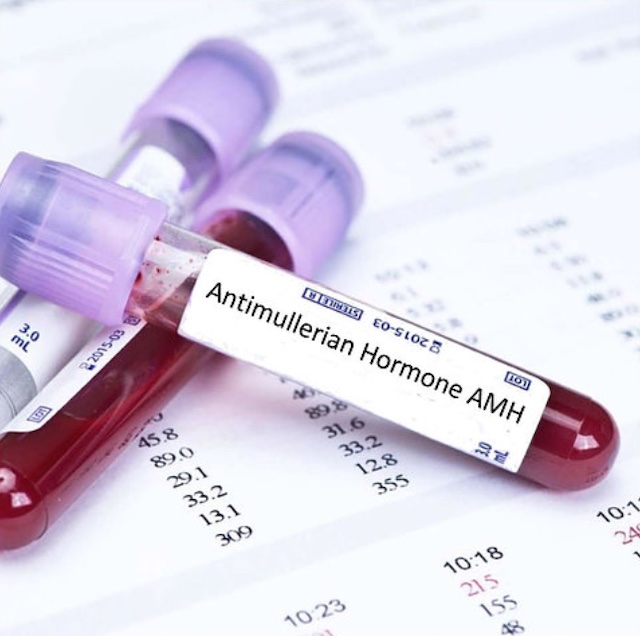 Anti-Mullerian Hormone