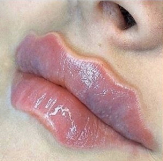 Devils Lips or Octopus Lips