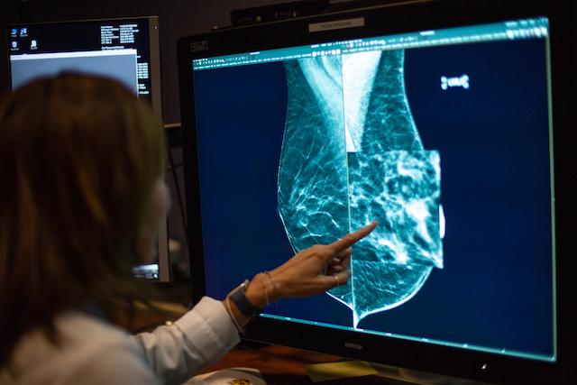 What Is Mammogram And How To Prepare For It?